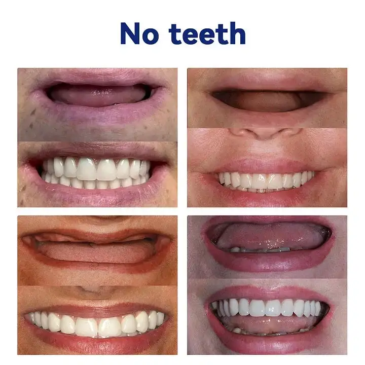 BBOJI™ New 72-Hour Denture Sale! 45% off + Free Ultrasonic Cleaner 1