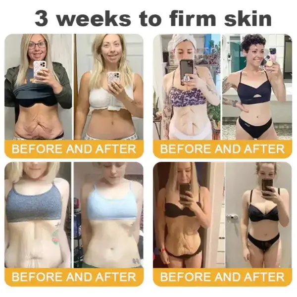 BBOJI™ Wrinkle Relaxer Bee Toxin Anti-Aging Firming Gel