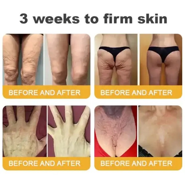 BBOJI™ Wrinkle Relaxer Bee Toxin Anti-Aging Firming Gel