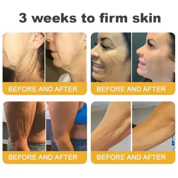 BBOJI™ Wrinkle Relaxer Bee Toxin Anti-Aging Firming Gel