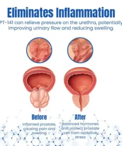 Ceoerty™ ProstaAce PT-141 Nasal Spray