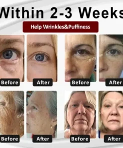 DefyAge™ Dragon Blood Advanced RepairSerum