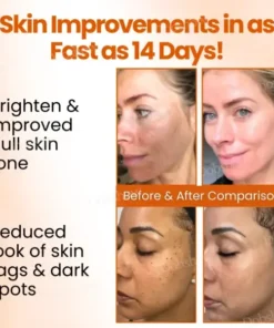 Dobshow™ SpotErase Trio Vitamin C 20% Removal Cream