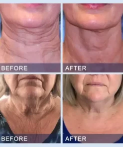 Furzero™ All-in-One Lifting & Firming Serum