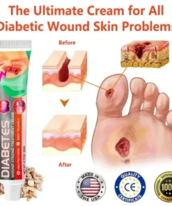 HZA™ Diabetes Wound Strong Treatment Cream