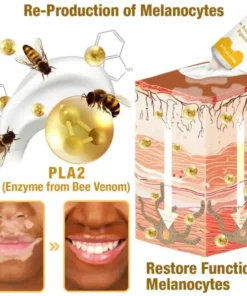LOVILDS™ BeeVenom Vitiligo Treatment Cream