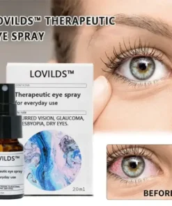 LOVILDS™ THERAPEUTIC EYE SPRAY