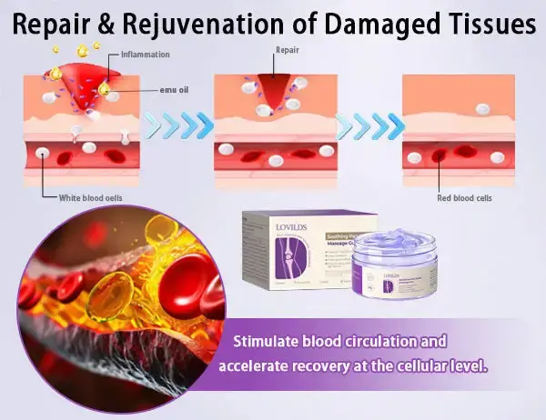 LOVILDS™ Turmeric & Emu Oil Arthritis Soothing Pain Relief Massage Gel