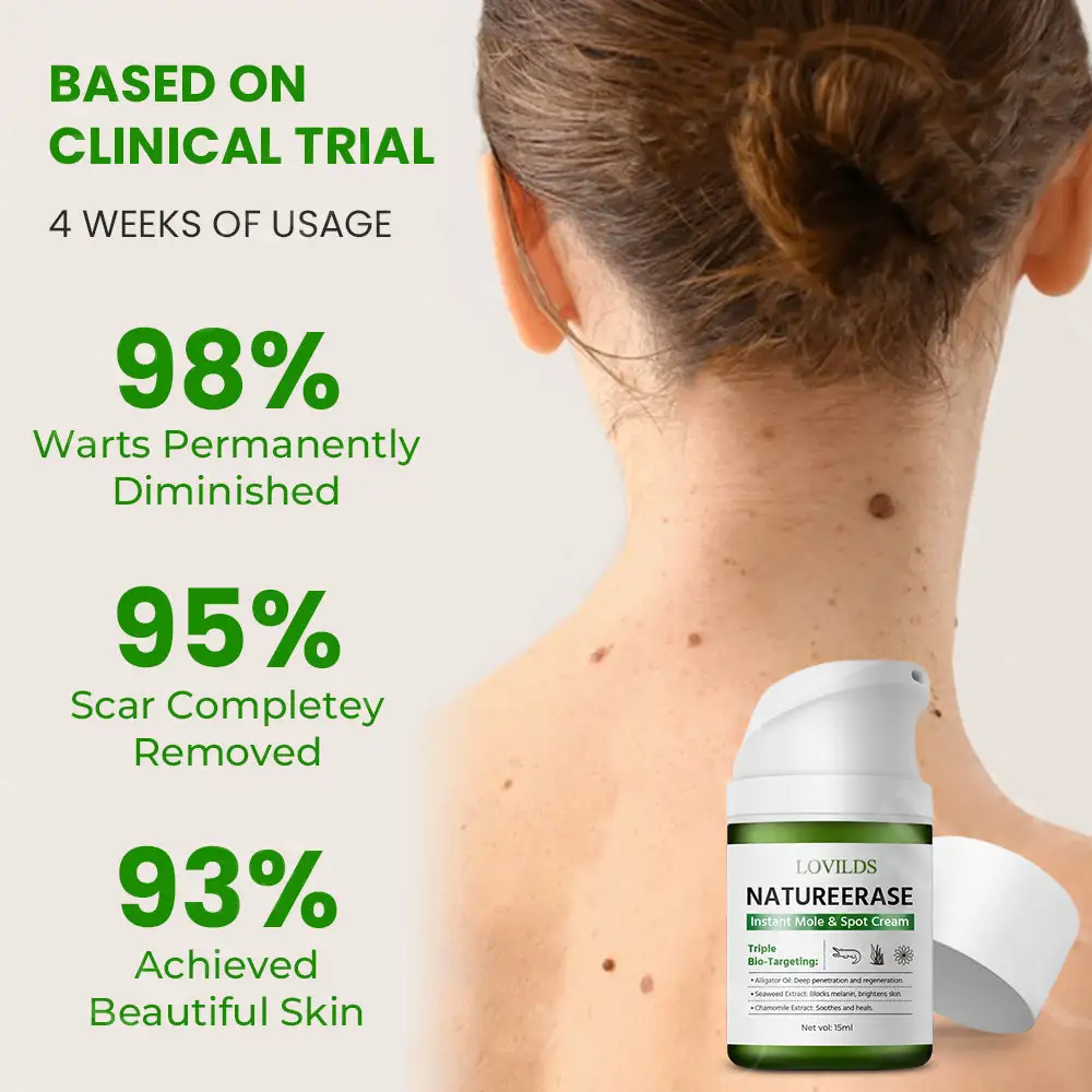 Lovilds™ NatureErase Instant Mole & Spot Cream