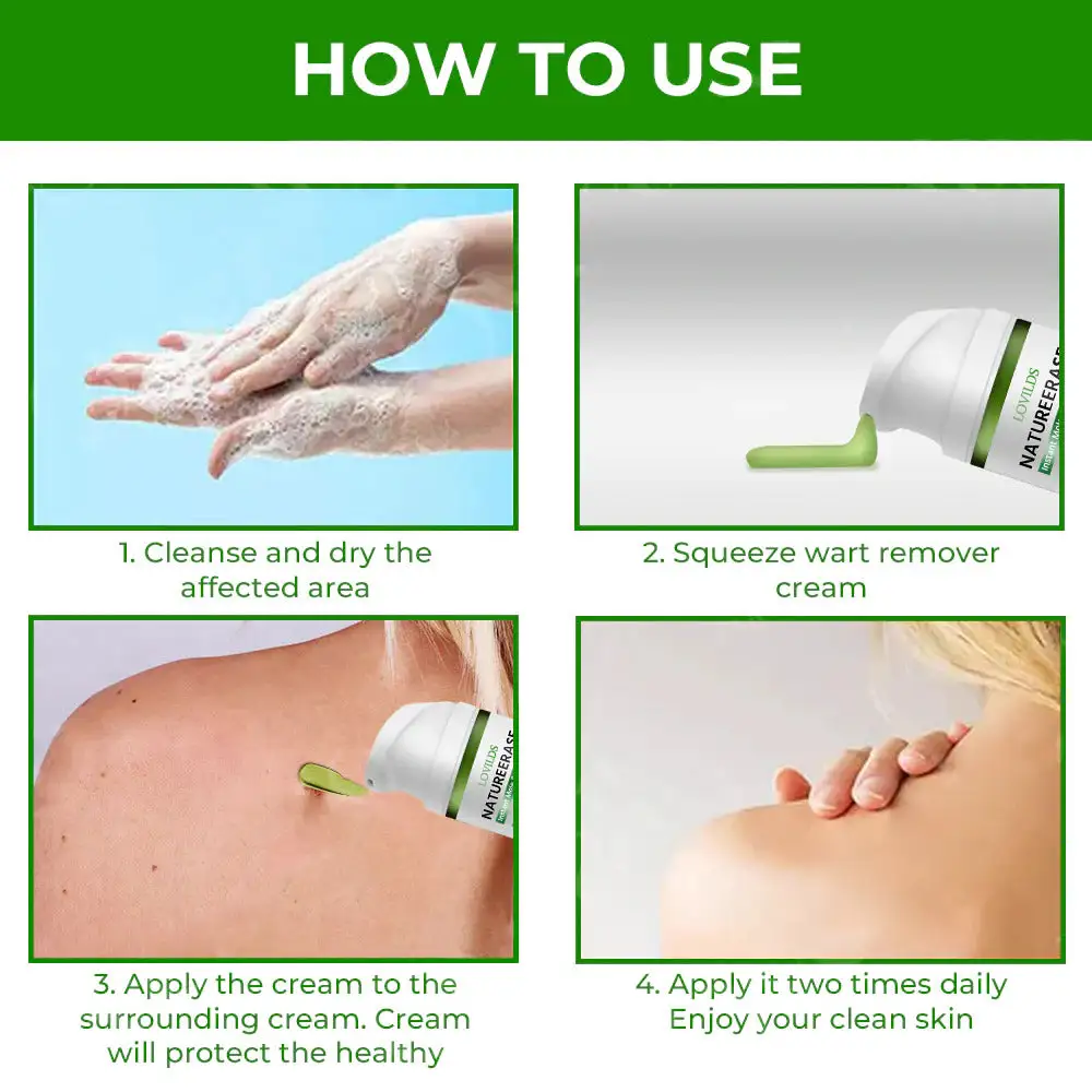 Lovilds™ NatureErase Instant Mole & Spot Cream