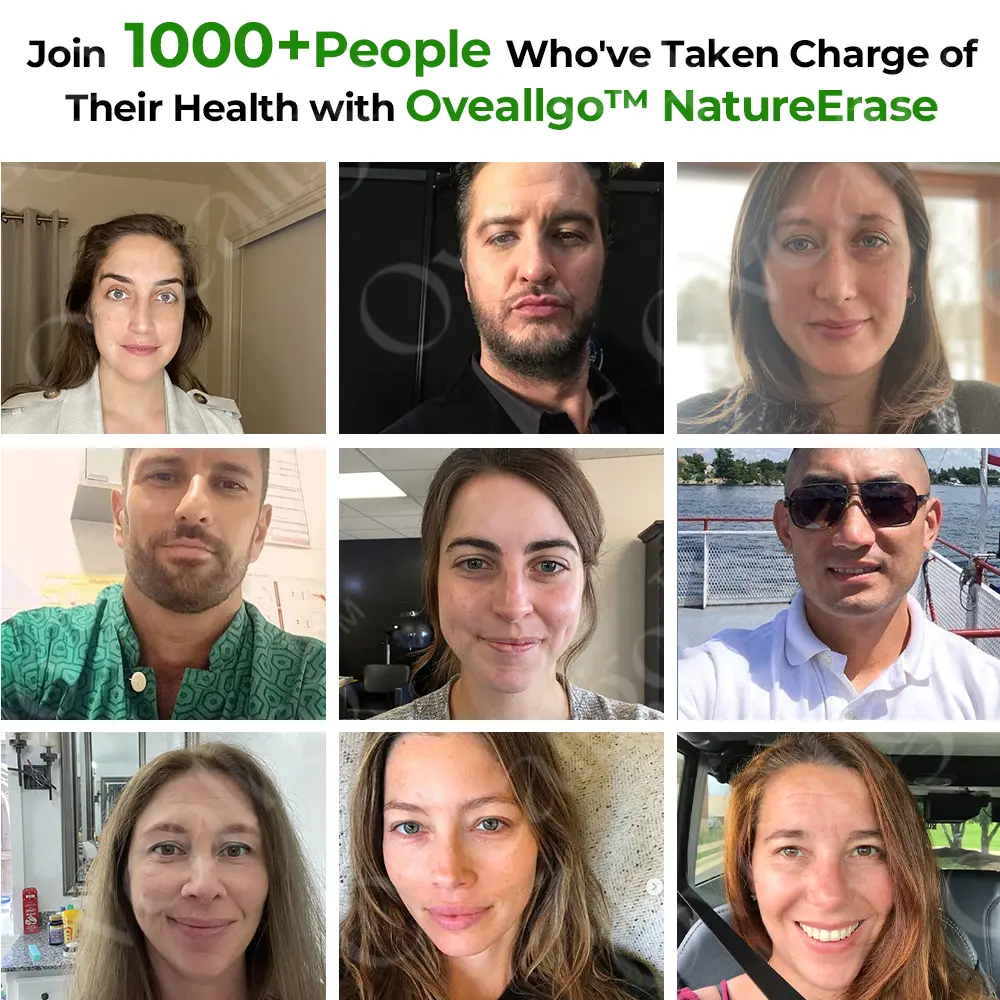 Lovilds™ NatureErase Instant Mole & Spot Cream