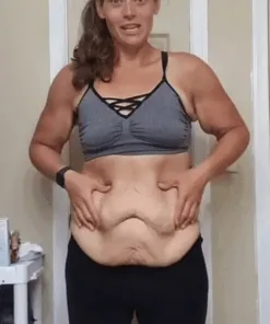 TAILEDEN™ Wrinkle Relaxer 𝐁𝐞𝐞 Toxin 𝐒𝐤𝐢𝐧 𝐑𝐞𝐩𝐚𝐢𝐫 𝐂𝐫𝐞𝐚𝐦