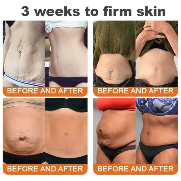 ADFIRE® Jamaican Castor Oil Firming Cream