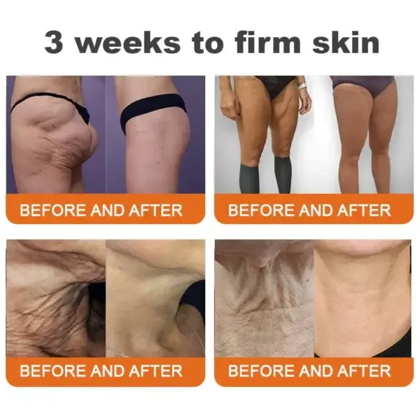 ADFIRE® Jamaican Castor Oil Firming Cream