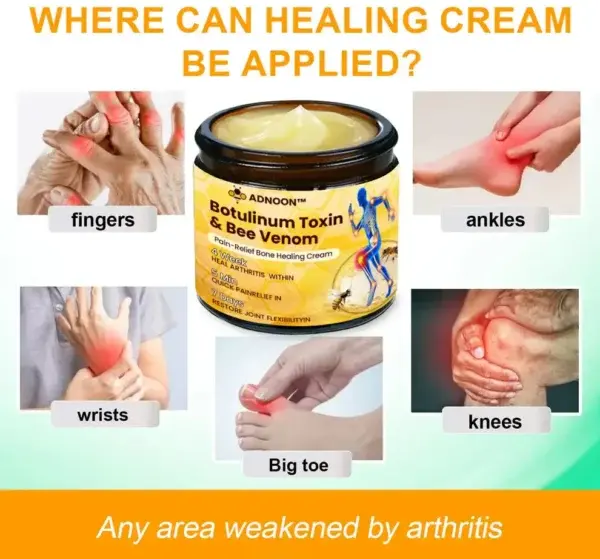 ADNOON™ Botulinum Toxin & Bee Venom Pain-Relief Bone Healing Cream