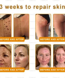 Daasry® "Dermal Gold" Botox Bee Venom Skin Restoration Cream