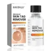 Fivfivgo™ Advanced Skin Tag Remover – Fast Action Formula
