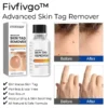 Fivfivgo™ Skin Tag Remover aurreratua - Ekintza azkarraren formula