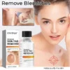 Fivfivgo™ Skin Tag Remover aurreratua - Ekintza azkarraren formula