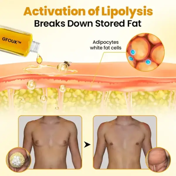 GFOUK™ ThermoFirm Bee Venom Gynecomastia Oil