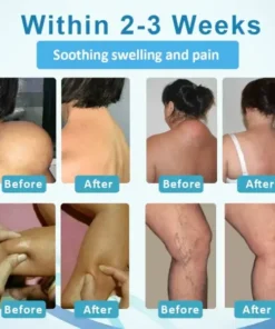 NEGUSY™ LumpsClear Lymph Support Roll-On