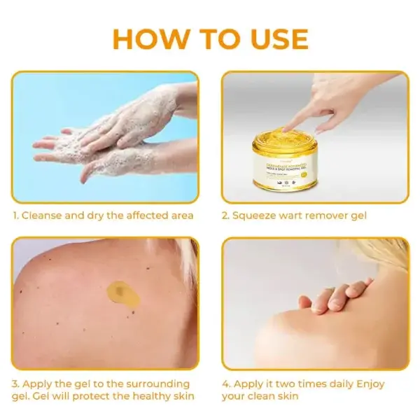 Oveallgo® DermaErase Mole adhartach & Gel toirt air falbh spot