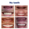 ROSOPL™ Smile Return