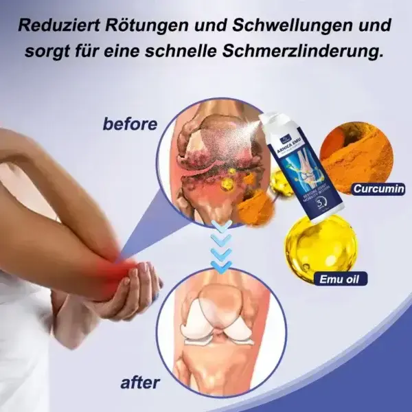 Raindew® Arnica Emu Joint Relief Complex