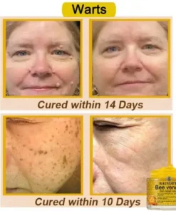 Raindew® Bee venom Skin repair cream