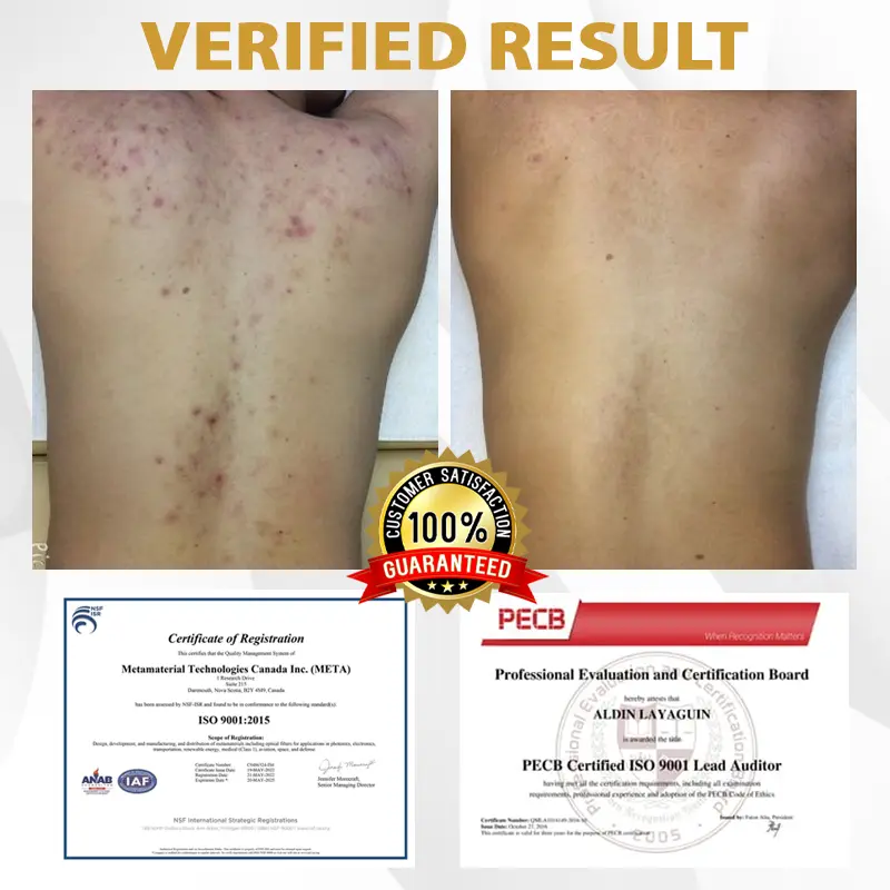 ATTDX® Advanced Mole & Spot Correcting Bee Gel