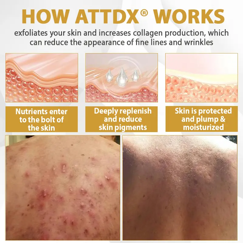 ATTDX® Advanced Mole & Spot Correcting Bee Gel