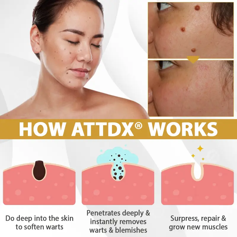 ATTDX® Advanced Mole & Spot Correcting Bee Gel