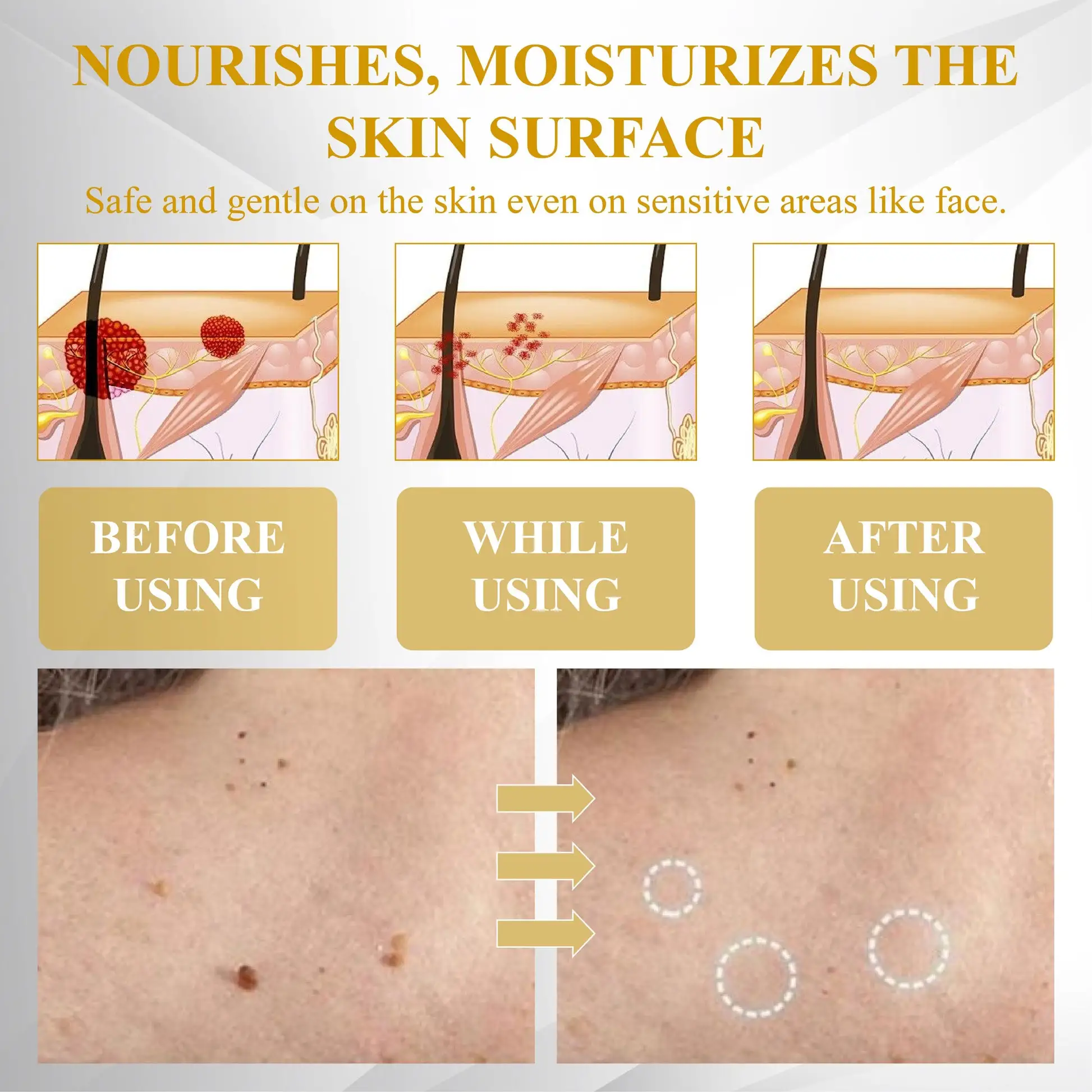 ATTDX® Advanced Mole & Spot Correcting Bee Gel