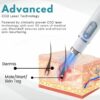 DermaZap™ Non-Invasive Mole and Wart Removal Laser Pen