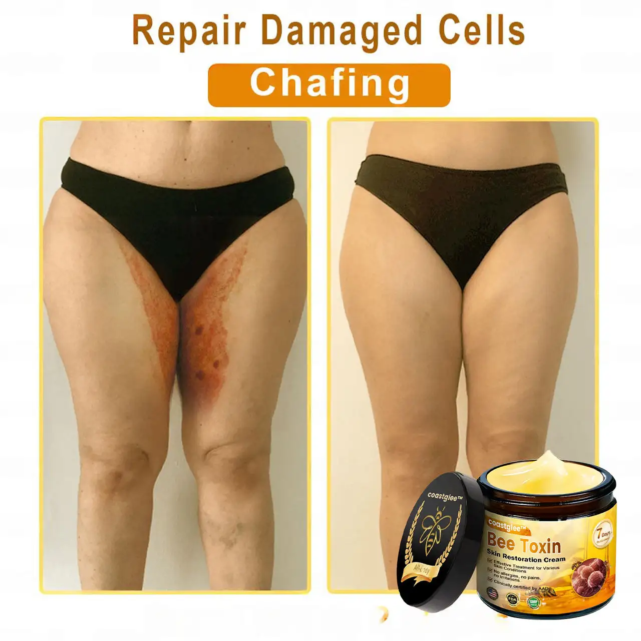 Official Flagship Store: coastglee® Skin Treatment Cream