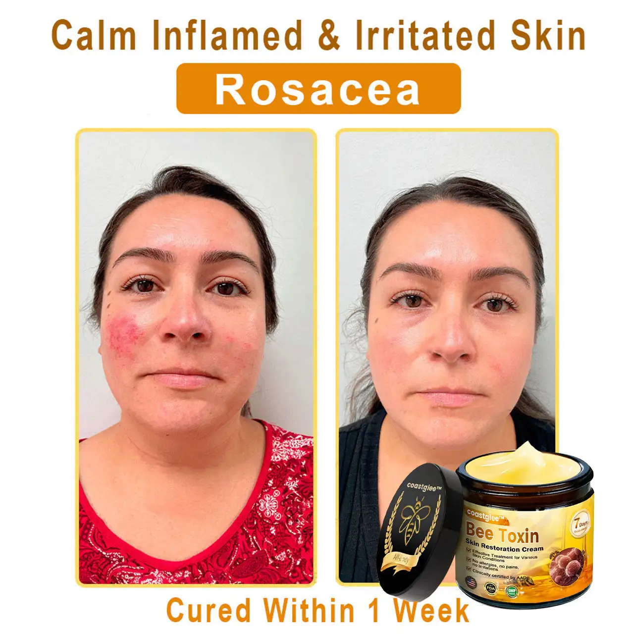 Official Flagship Store: coastglee® Skin Treatment Cream