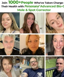 ✅Official Store: Personana® Advanced Bio-Oil Mole & Spot Corrector