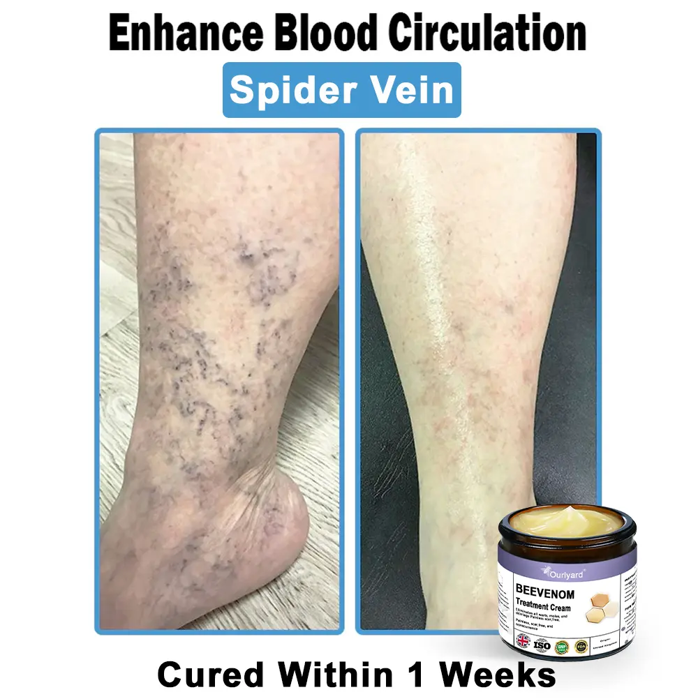 Ourlyard® Bee Venom Skin Treatment Cream