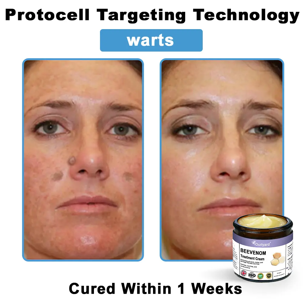 Ourlyard® Bee Venom Skin Treatment Cream