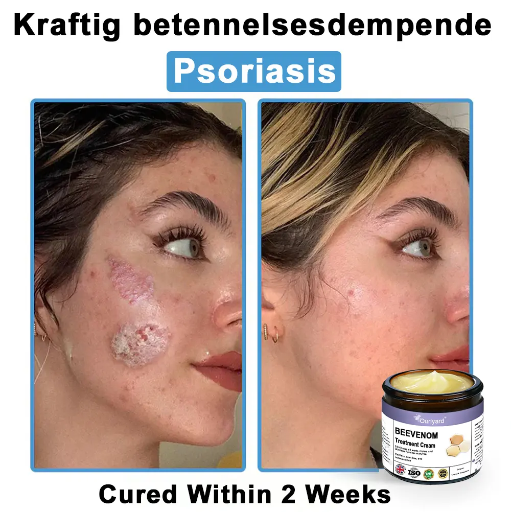 Ourlyard® Bee Venom Skin Treatment Cream