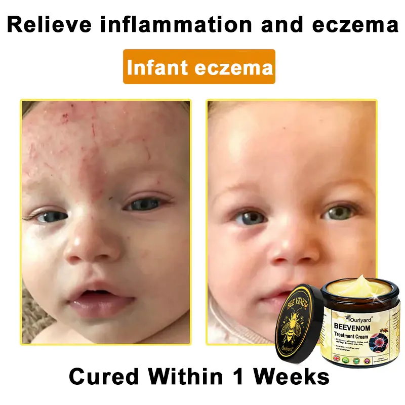 Ourlyard® Botulinum Toxin & Bee Venom Skin Treatment Cream