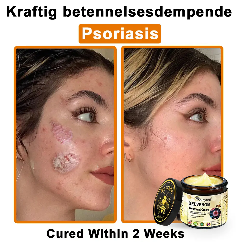 Ourlyard® Botulinum Toxin & Bee Venom Skin Treatment Cream