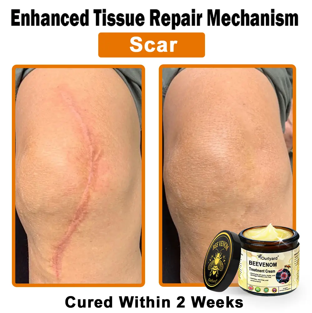 Ourlyard® Botulinum Toxin & Bee Venom Skin Treatment Cream