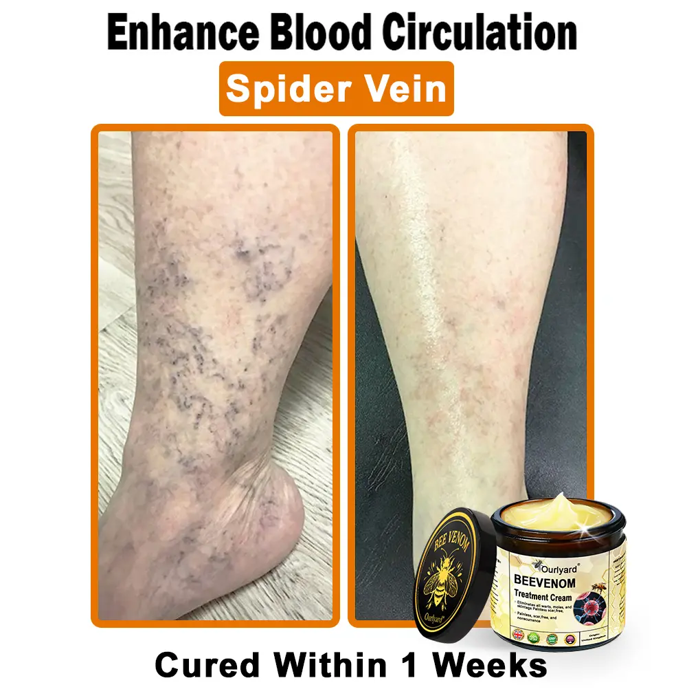 Ourlyard® Botulinum Toxin & Bee Venom Skin Treatment Cream