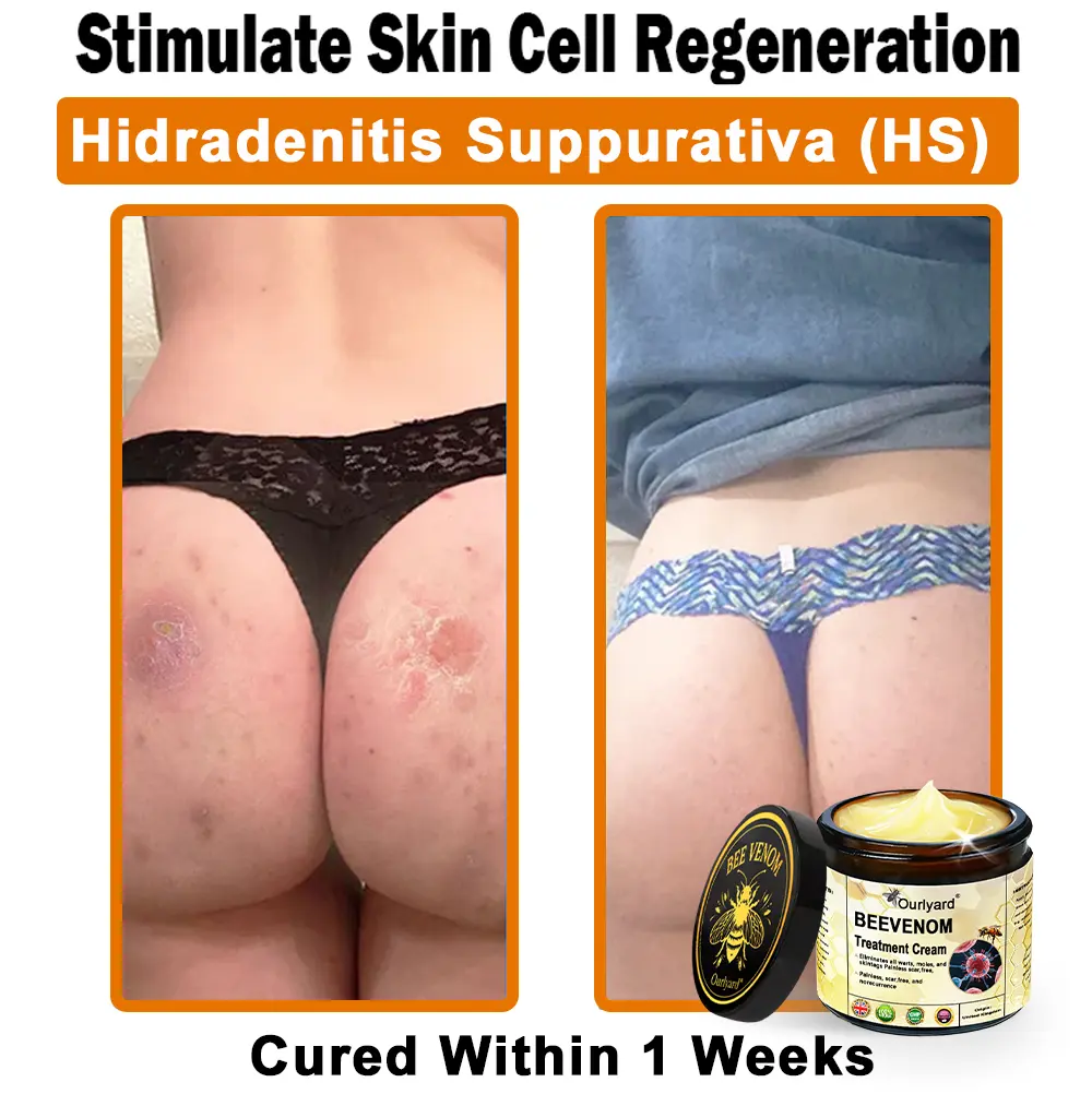 Ourlyard® Botulinum Toxin & Bee Venom Skin Treatment Cream