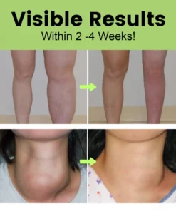 Personana™ Herbal Lymphatic Detox Cream