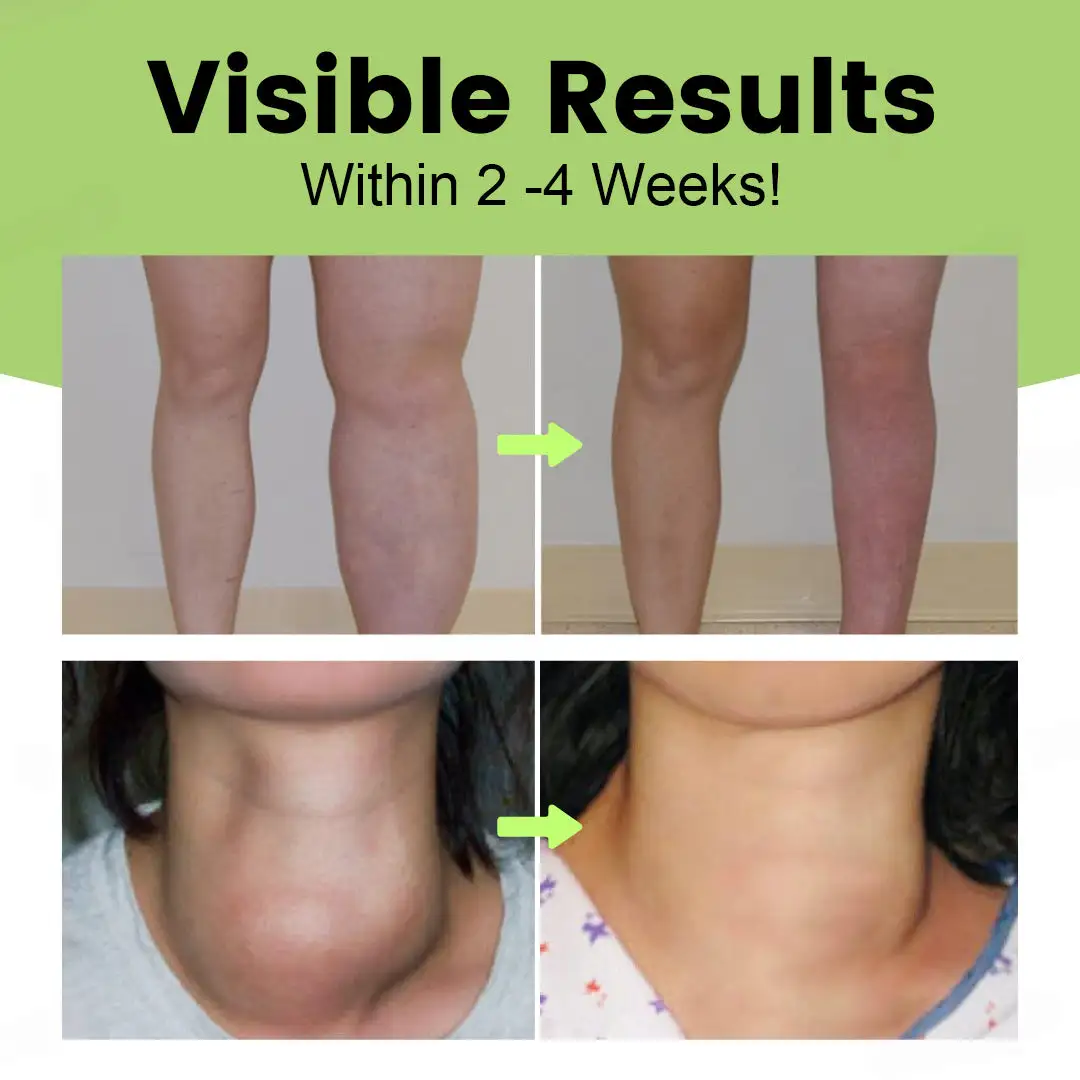 Personana™ Kräuter-Lymph-Entgiftungscreme