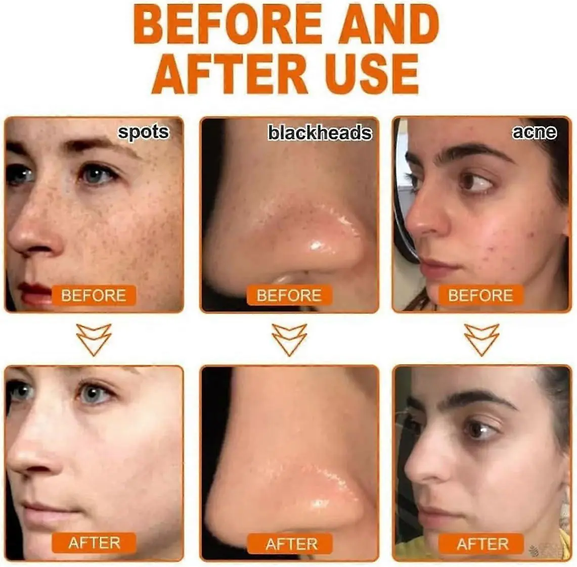 Slimoly™ Whitening and Freckle - Removing Mask