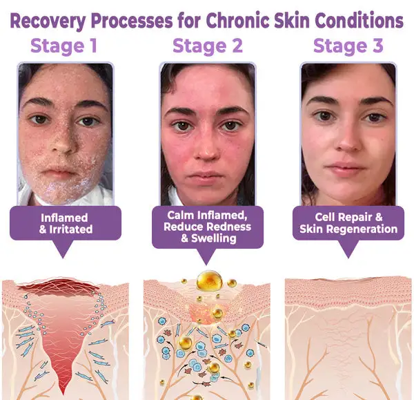 coastglee™ Advanced Mole & Spot Removal Gel(U.S. FDA approved)