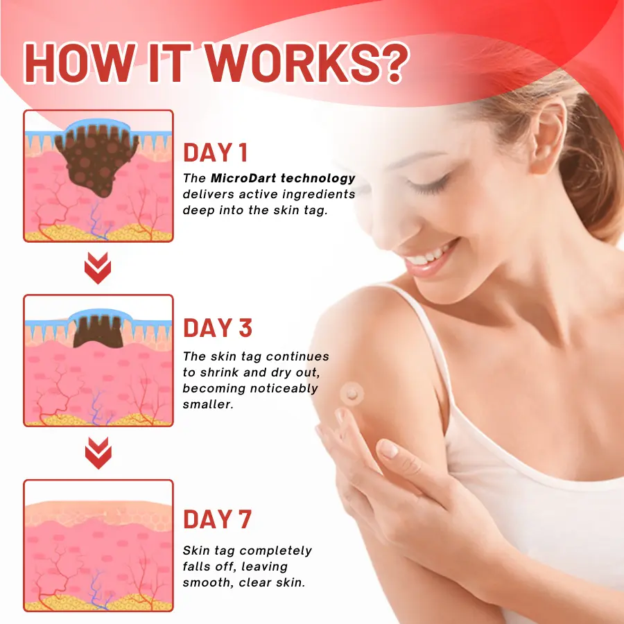 coastglee® MicroDart Skin Tag Remover Patch